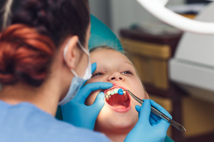 Bellevue Fluoride Treatment