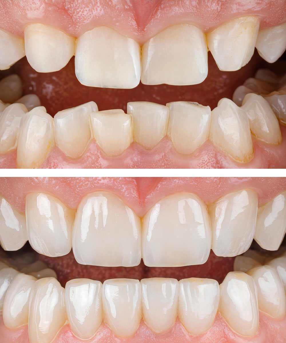 Sammamish Kids Dentist Office